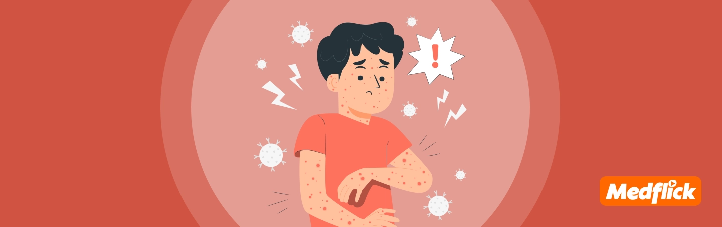 m-pox-infection-key-symptoms-smart-prevention-and-expert-care-tips